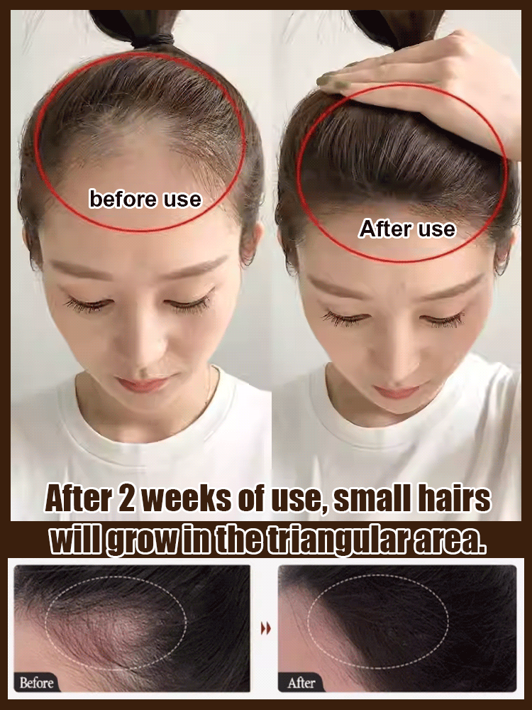 【7 Days Hair Growth!】He Shou Wu Essence Herbal Shampoo