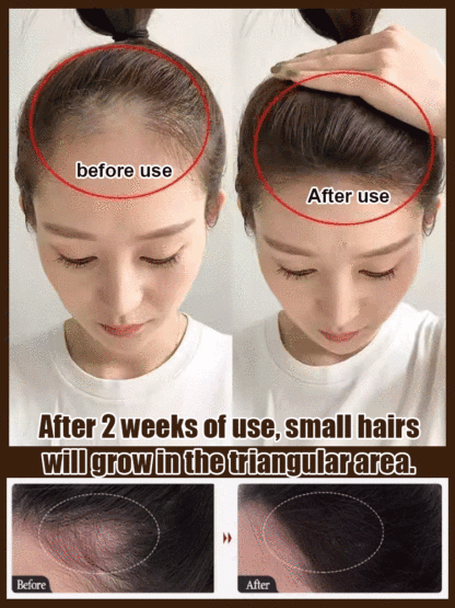 【7 Days Hair Growth!】He Shou Wu Essence Herbal Shampoo