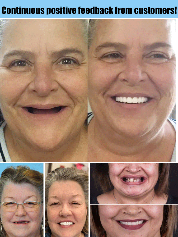 Silicone simulation temporary dentures