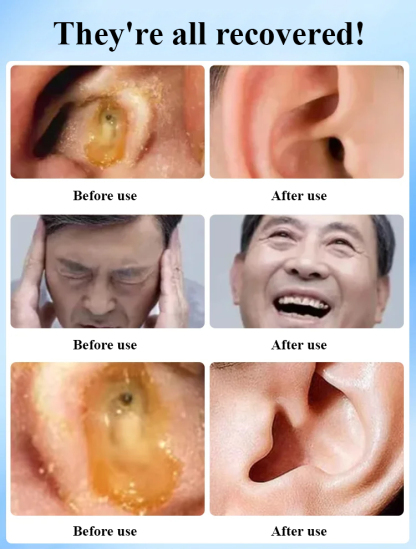 【Focus on ear health】Earwax cleaner