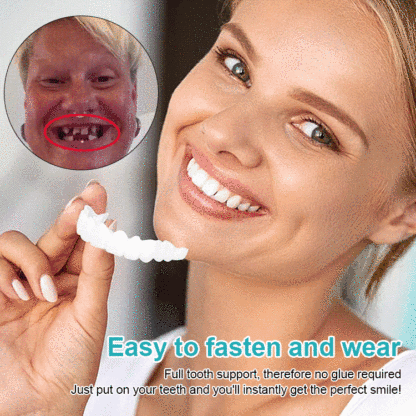 Adjustable Snap-on Dentures