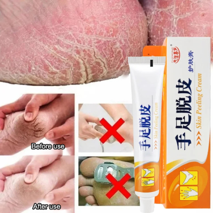 [Special for peeling] Antibacterial cream for hands and feet
