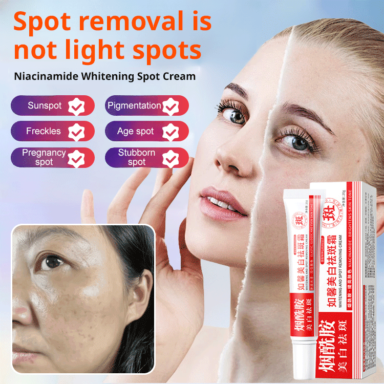 Niacinamide Whitening Anti-Freckle Cream