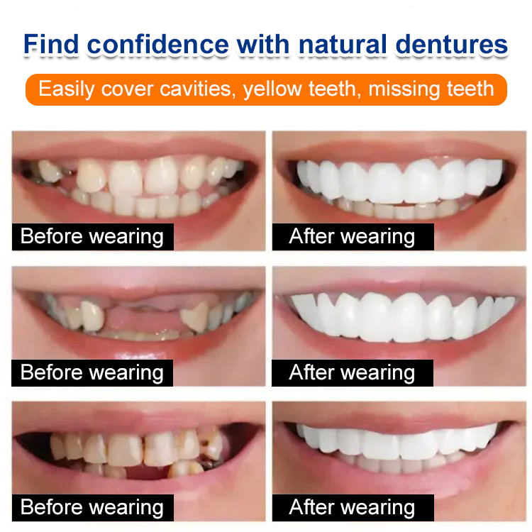 Whitening artificial teeth dentures