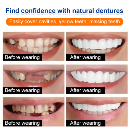 Whitening artificial teeth dentures