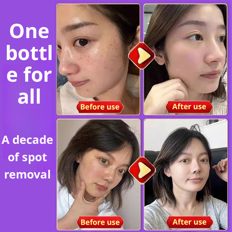 Niacinamide Whitening Anti-Freckle Cream