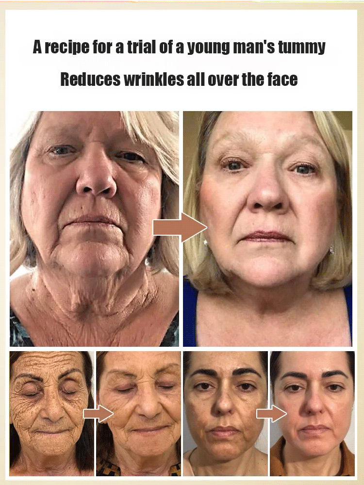 Astaxanthin Moisturizing Anti-Wrinkle Cream