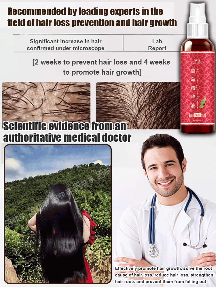 【7 Days Hair Growth!】He Shou Wu Essence Herbal Shampoo