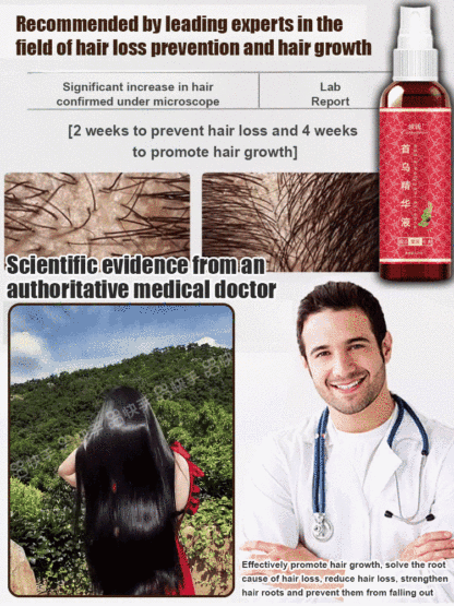 【7 Days Hair Growth!】He Shou Wu Essence Herbal Shampoo