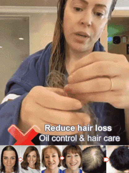Hot Sale Ginger Plant Extract Anti-Hair Loss Hair Shampoo