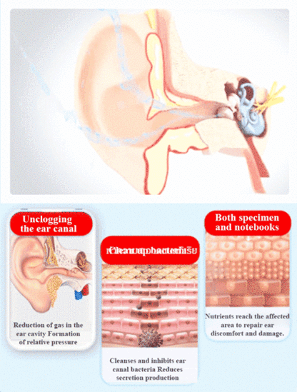 【Focus on ear health】Earwax cleaner