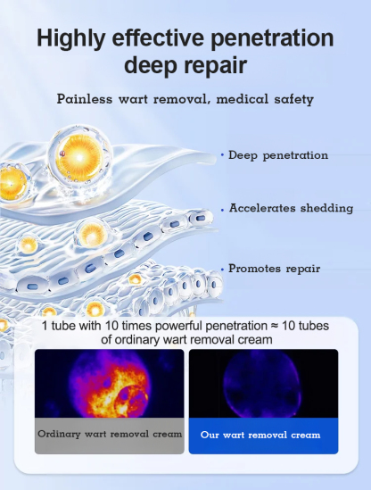 【Wart Removal Cream】Medical Cooling Gel Wart Clear