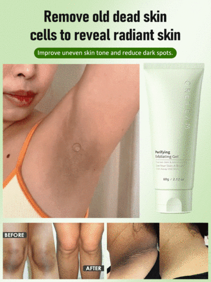 Effortlessly Shed a Layer of Skin! Popular Exfoliating Gel in Japan and Korea