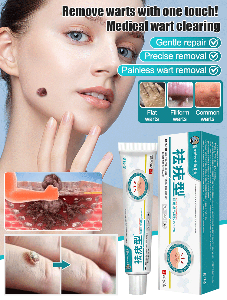 【Wart Removal Cream】Medical Cooling Gel Wart Clear