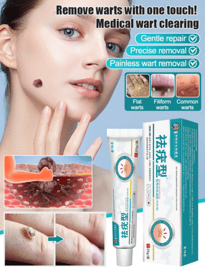 【Wart Removal Cream】Medical Cooling Gel Wart Clear