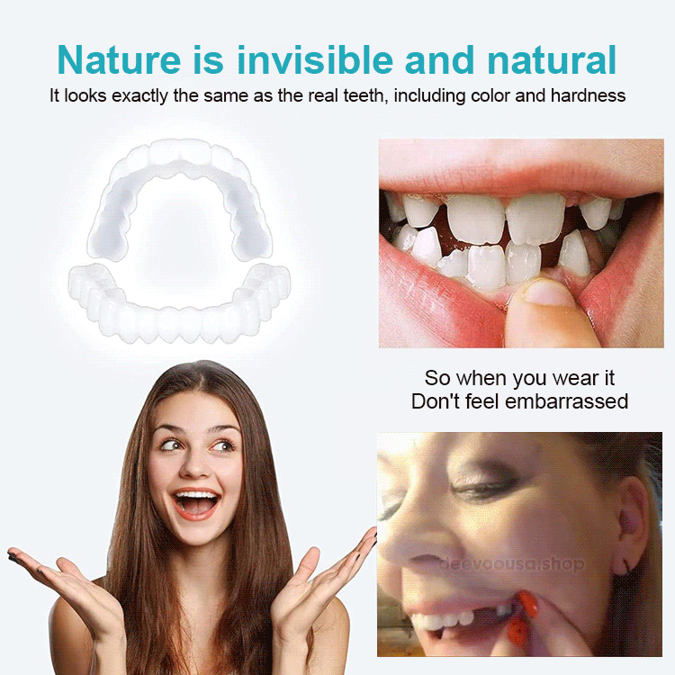 Adjustable Snap-on Dentures