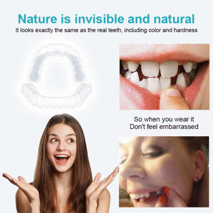 Adjustable Snap-on Dentures