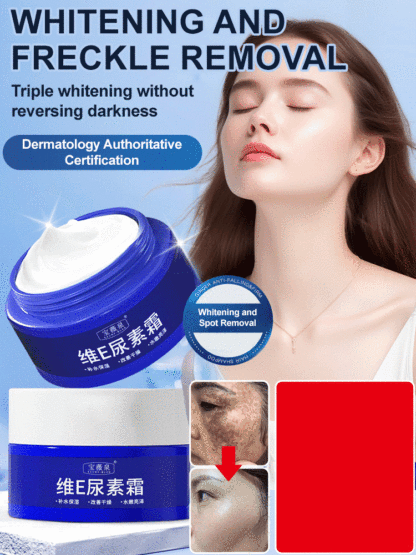 【Old Spots and Yellow Spots Disappear】Spot Fading Urea Cream