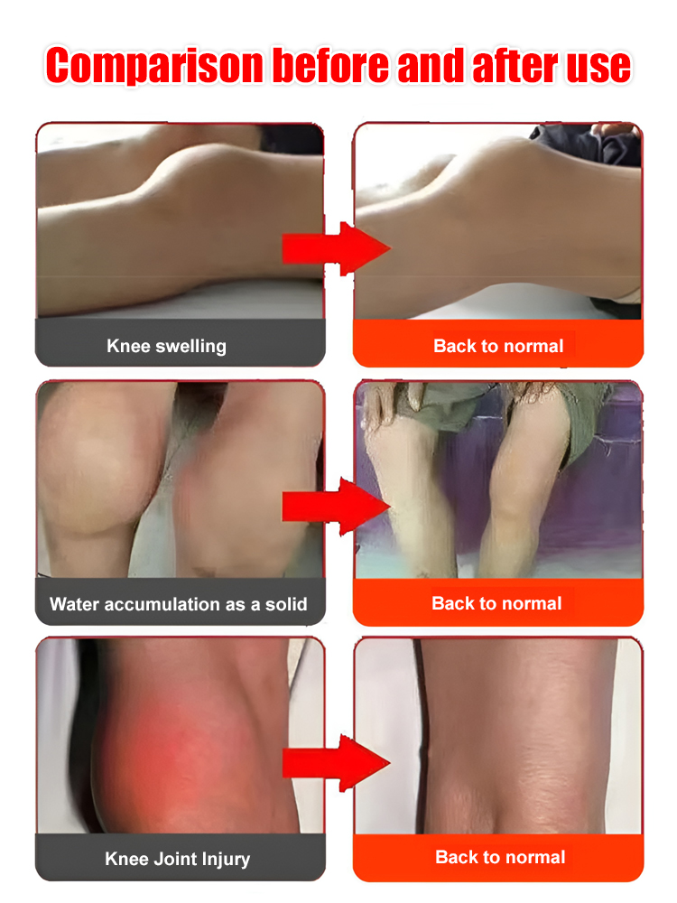 Brand new upgraded De Rong heated knee pads
