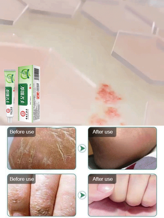 Hong Kong Pharmacy Hand and Foot Peeling Skin Care Cream