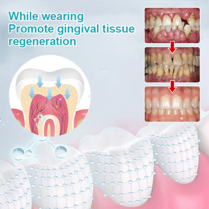 Adjustable Snap-on Dentures