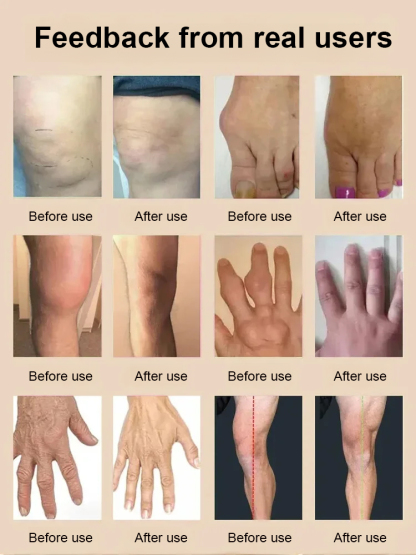 [Apply wherever it hurts] Glucosamine joint care cream