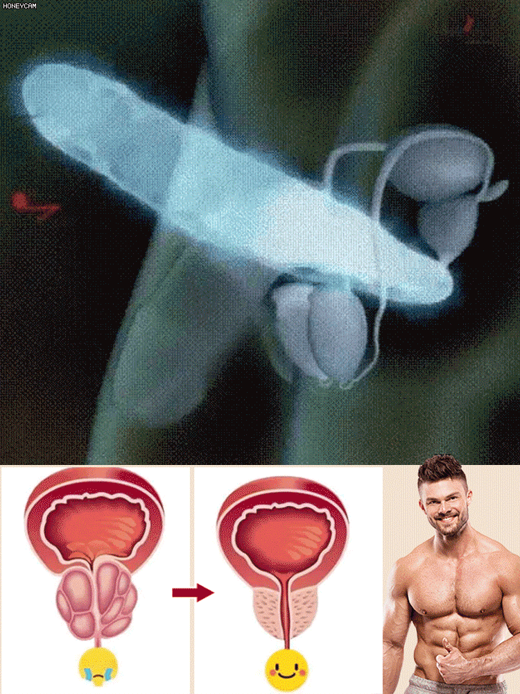 Gentle Herbal Prostate Conditioning Acupoint Patch