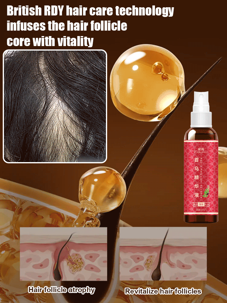 【7 Days Hair Growth!】He Shou Wu Essence Herbal Shampoo