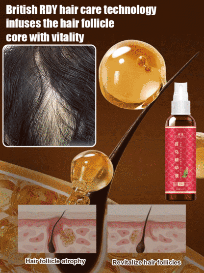 【7 Days Hair Growth!】He Shou Wu Essence Herbal Shampoo
