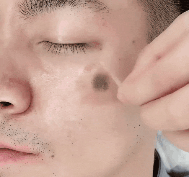 10-9-杨新育-1104470SL-两周吸走黑斑淡斑抗皱面膜_06.gif