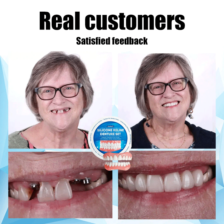 ORALHOE Smile Enhancement Denture Kit