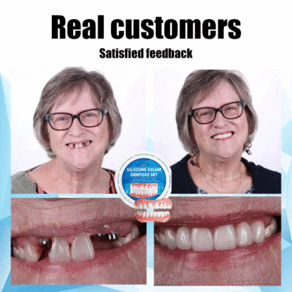 ORALHOE Smile Enhancement Denture Kit