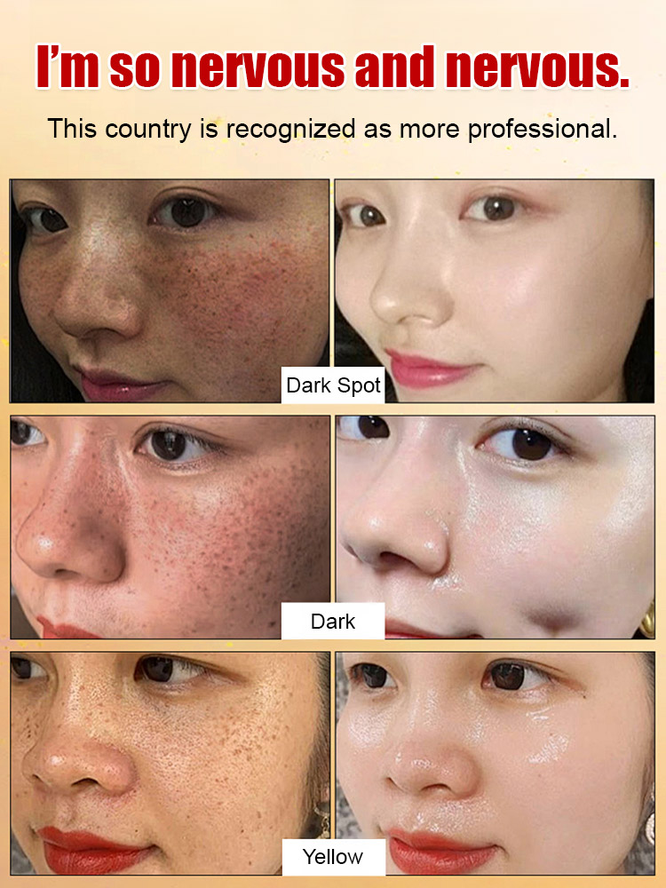 [Specially for stubborn spots] Upgraded anti-freckle essence oil