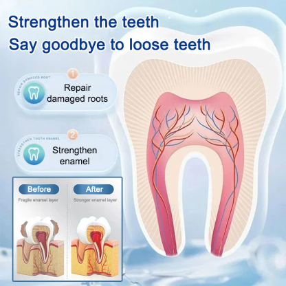 [Dental Specialty] Teeth Repair Toothpaste