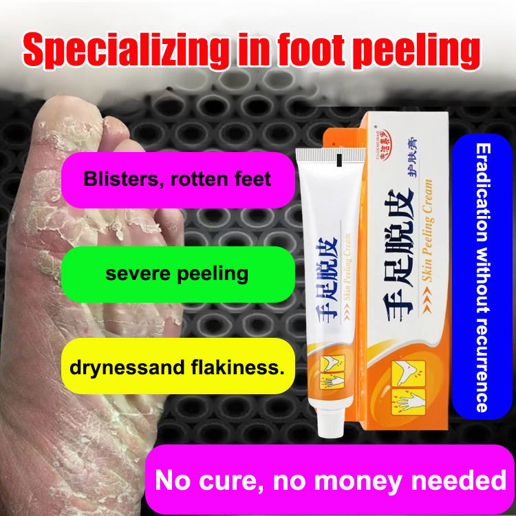 [Special for peeling] Antibacterial cream for hands and feet