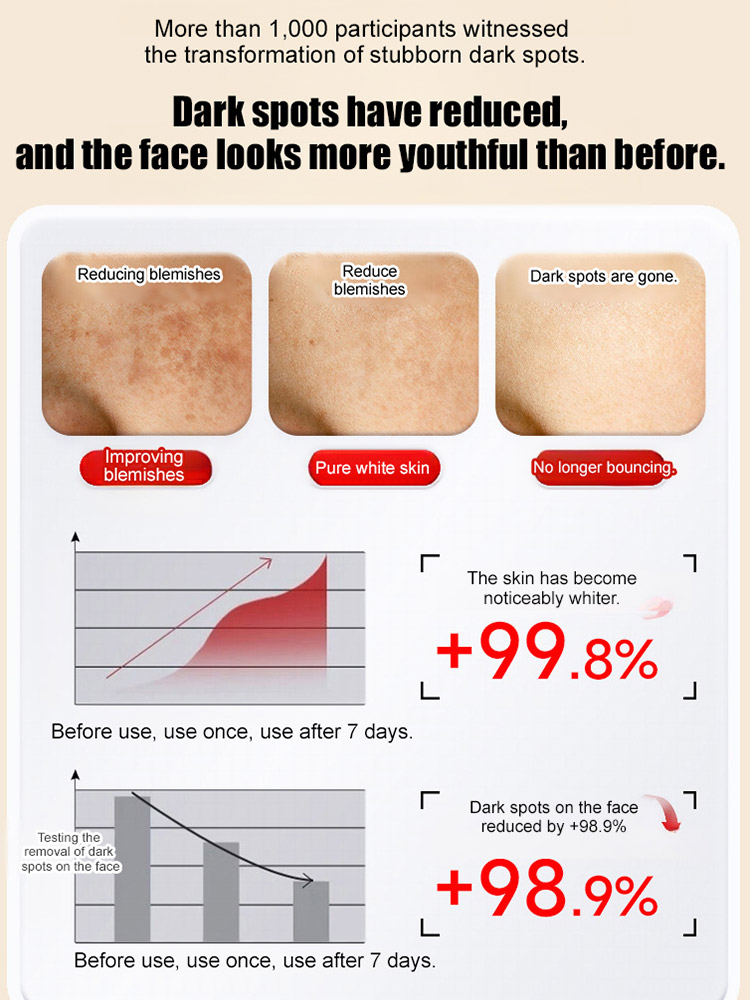 [Specially for stubborn spots] Upgraded anti-freckle essence oil