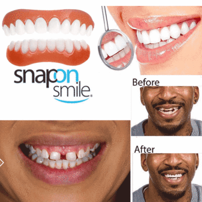 ORALHOE Smile Enhancement Denture Kit