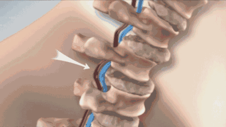 翻译件-SL-【颈部活血】加热艾草护颈枕-1119286_13.gif