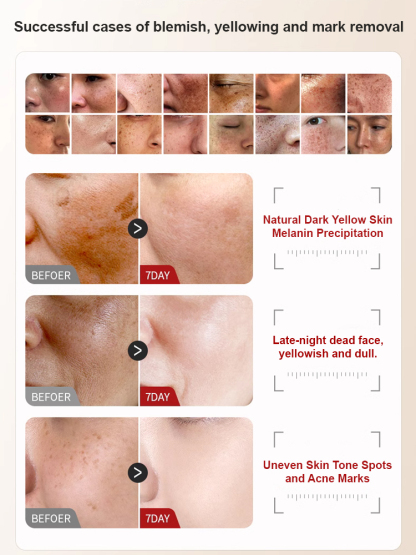 Whitening over light bulb] Yushintang Whitening Spot Cream