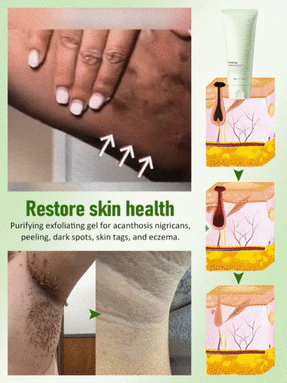 Effortlessly Shed a Layer of Skin! Popular Exfoliating Gel in Japan and Korea