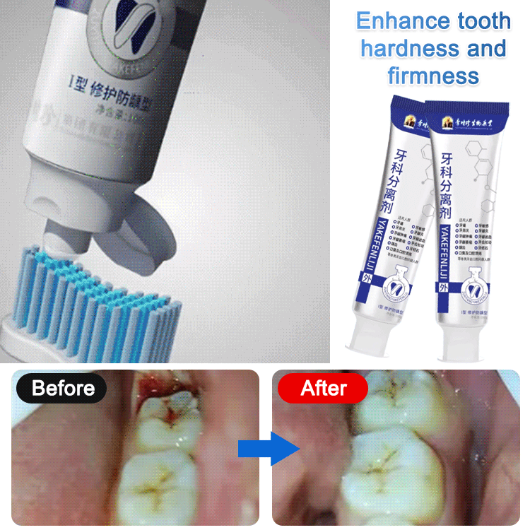 [Dental Specialty] Teeth Repair Toothpaste