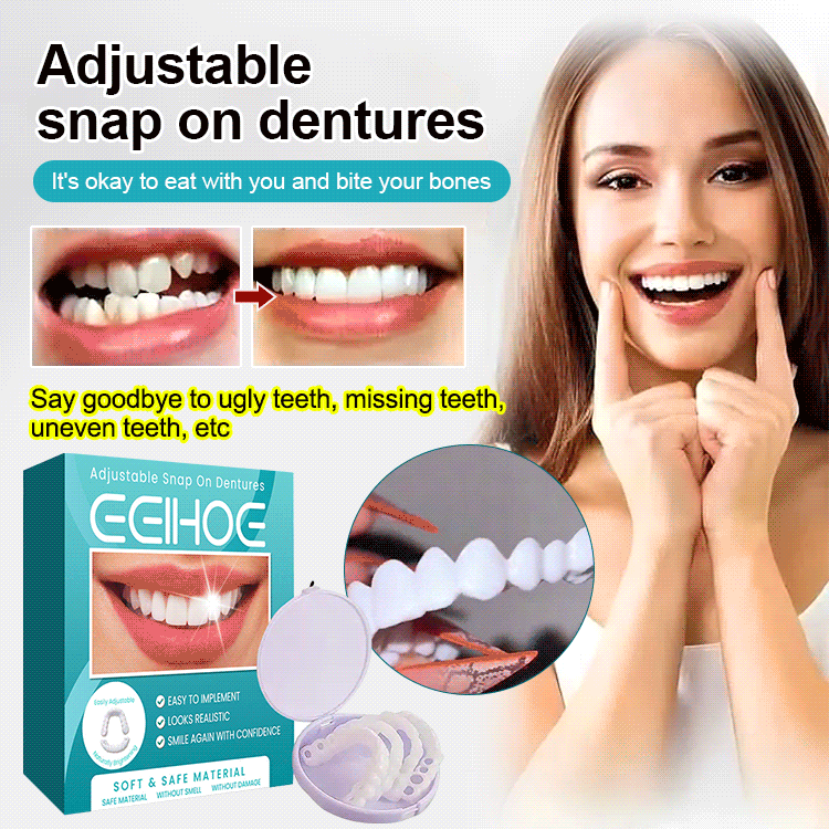 Adjustable Snap-on Dentures