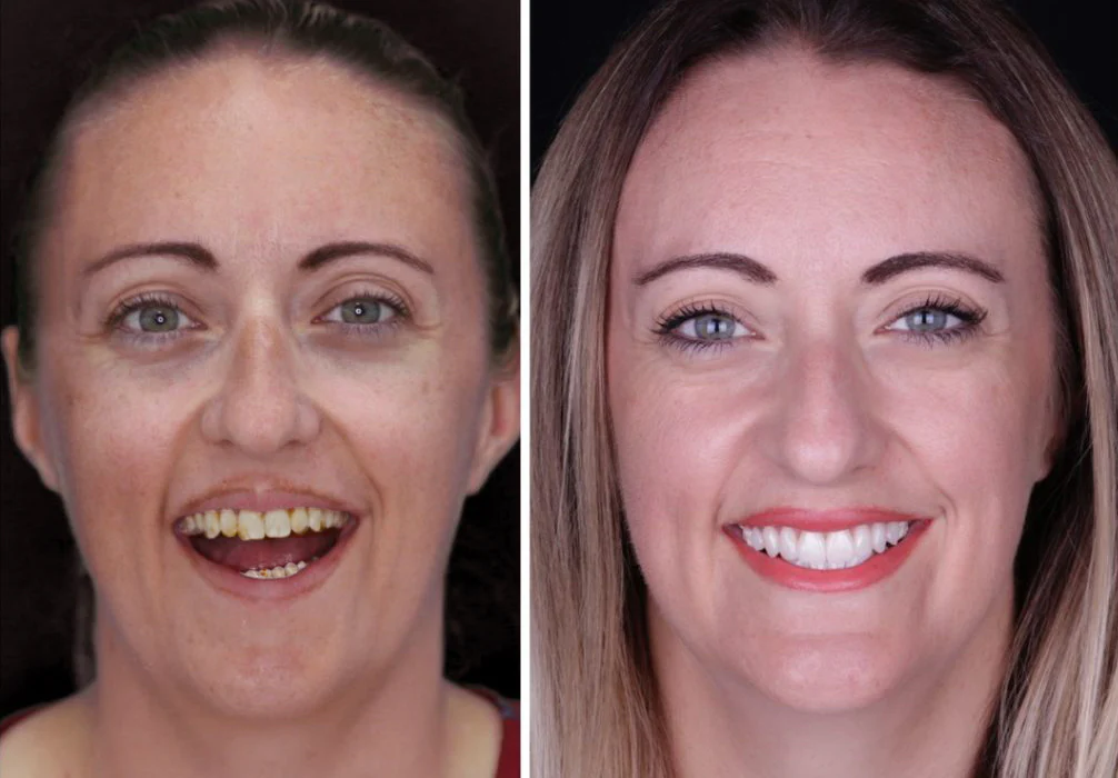before_after_4.webp