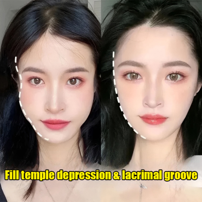 Polypeptide Collagen Filling Cream