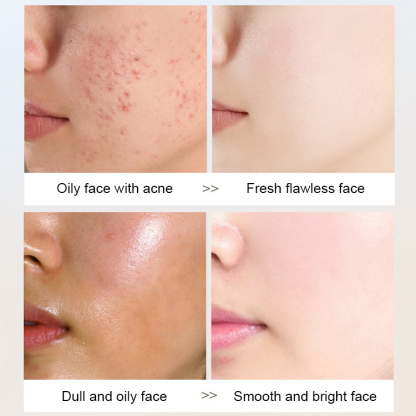 Skin whitening facial cleanser