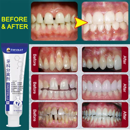 [Dental Specialty] Teeth Repair Toothpaste
