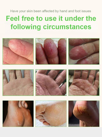 Hong Kong Pharmacy Hand and Foot Peeling Skin Care Cream