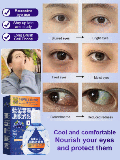 【Relieve Eye Fatigue】Blueberry Lutein Eye Drops for Alleviating Eye Fatigue