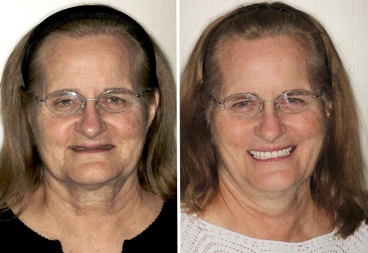 before_after_2_a3aed35f-2881-409a-9a8c-e1172d699d03.webp