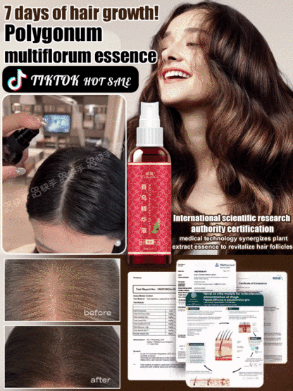 【7 Days Hair Growth!】He Shou Wu Essence Herbal Shampoo